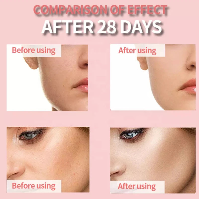 Custom Private Label Skin Care Facial Serum 4 in 1 Anti-aging Whitening 30% Vitamin C 5% Niacinamide 10% Vitamin E HA Face Serum